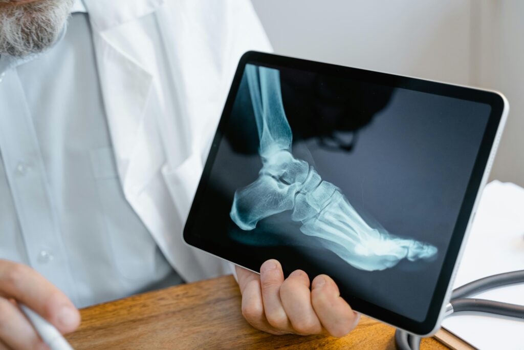 pexels-photo-8376138-8376138 A doctor examines an x-ray image of a foot displayed on a tablet.