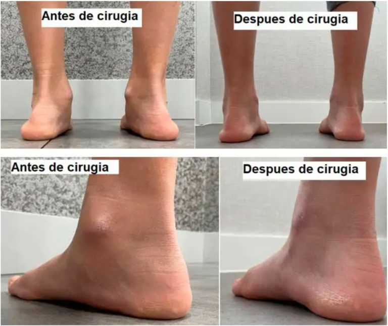 traumatologo pie y tobillo Barcelona