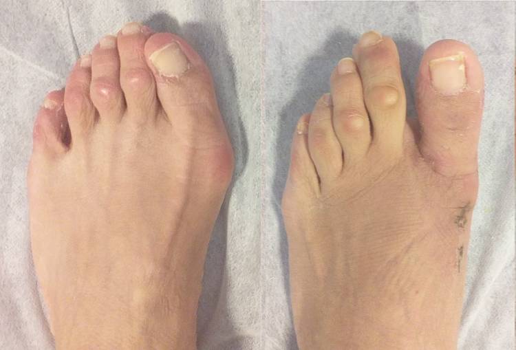 traumatologo pie y tobillo Barcelona