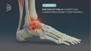 esguince de tobillo